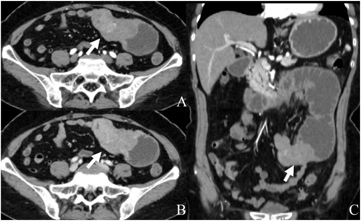 Figure 1