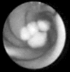 Fig. 3
