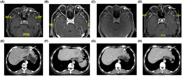 FIGURE 1