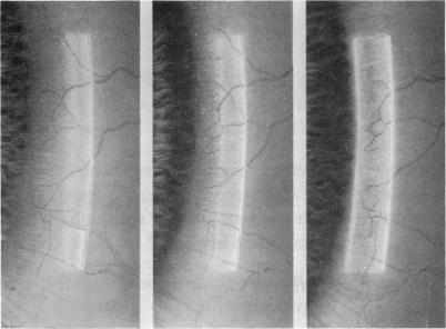 FIGURE 1. A,B,C