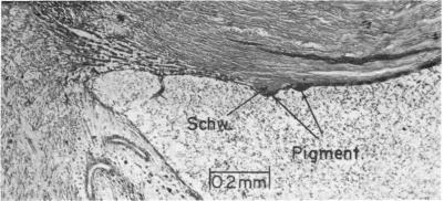 FIGURE 17.