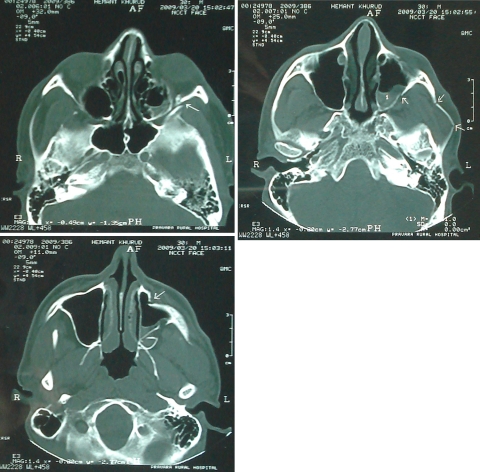 Fig. 1