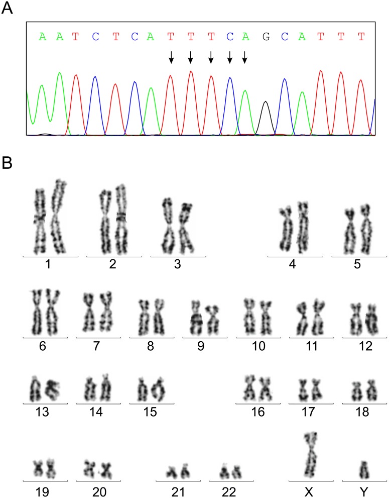 Fig 4