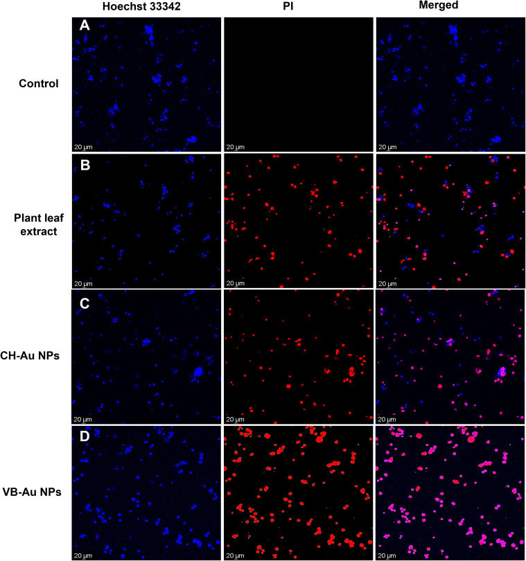 Figure 11