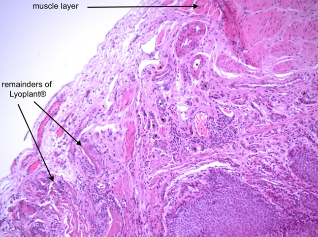 Fig. 4