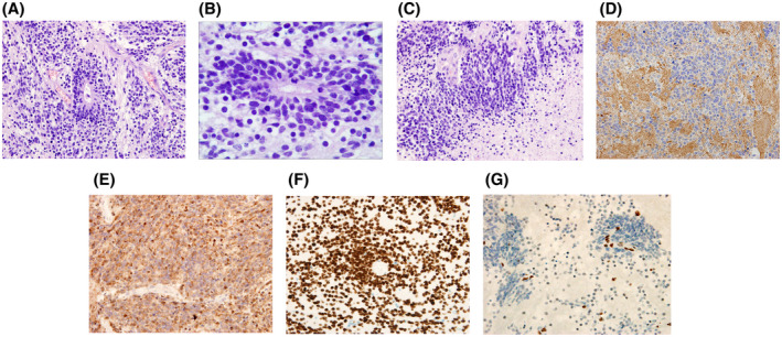 FIGURE 2