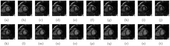 Figure 14