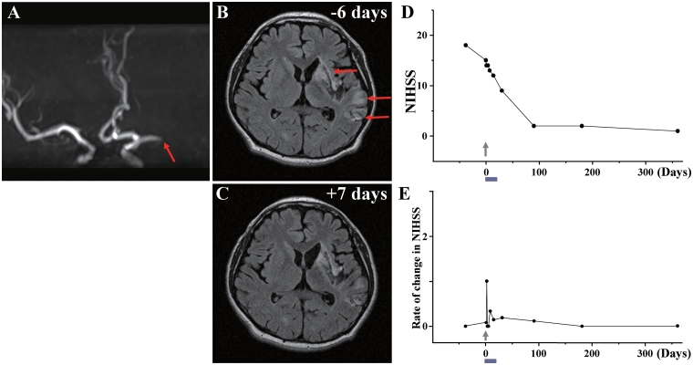 Figure 11