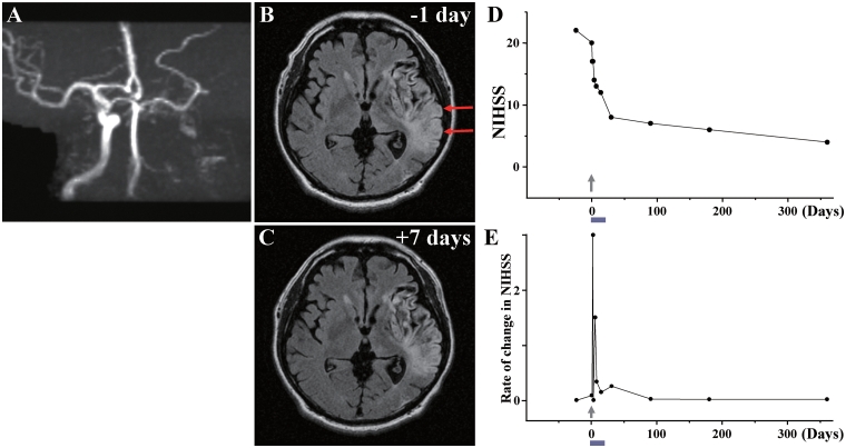 Figure 12