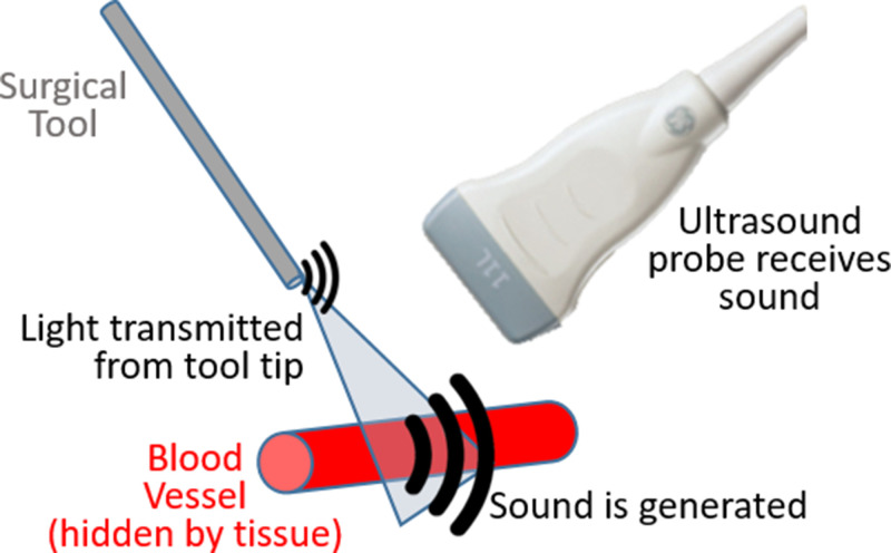 FIG. 1.