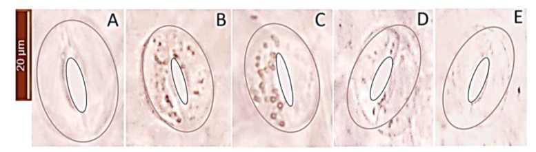 Figure 11