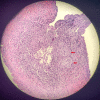 Fig. 2