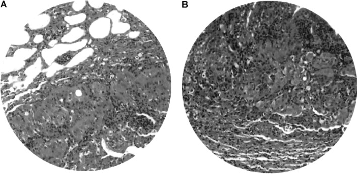 Figure 11.