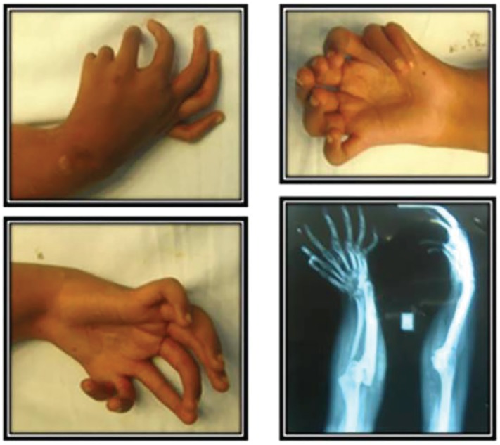 Fig. 1