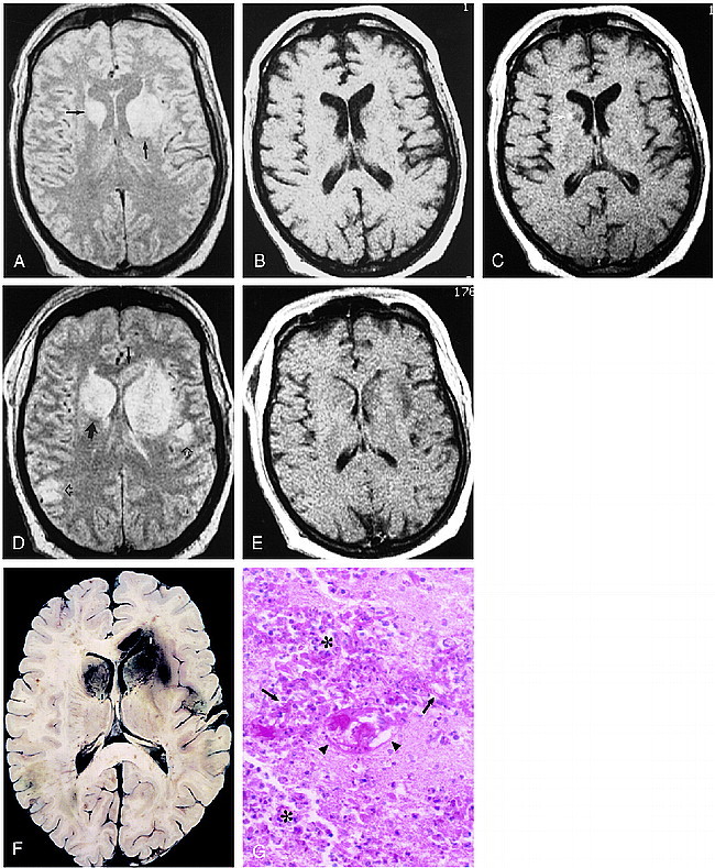 fig 1.