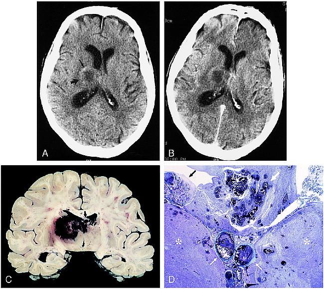 fig 2.