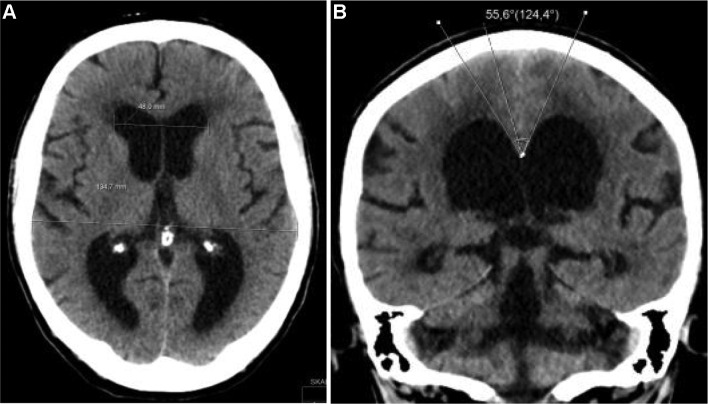 Fig. 2