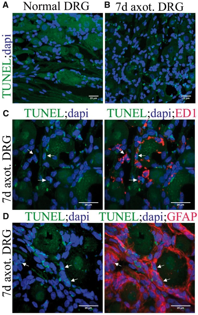 FIGURE 11.