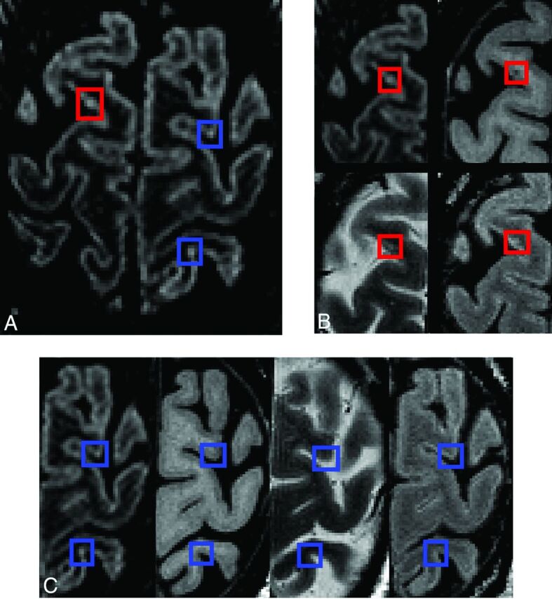 Fig 3.