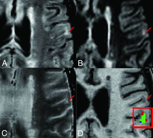 Fig 1.