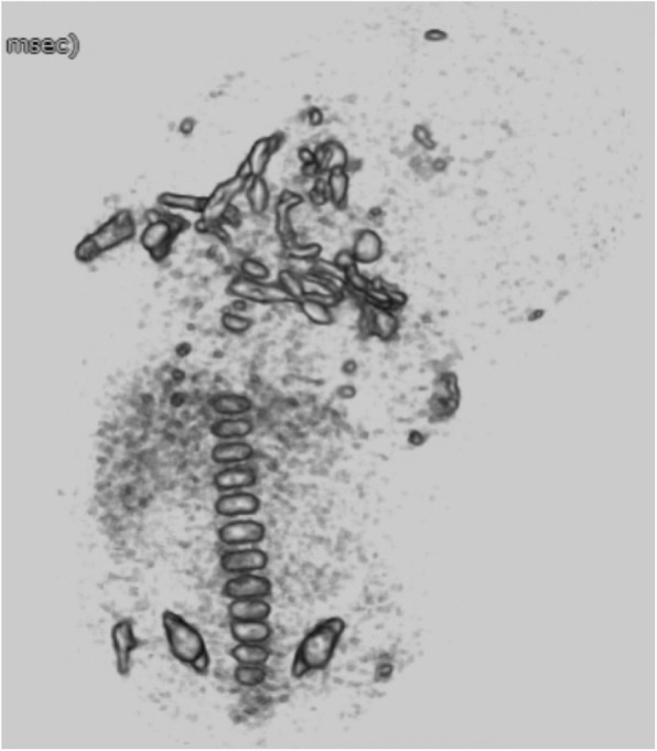 Fig. 4