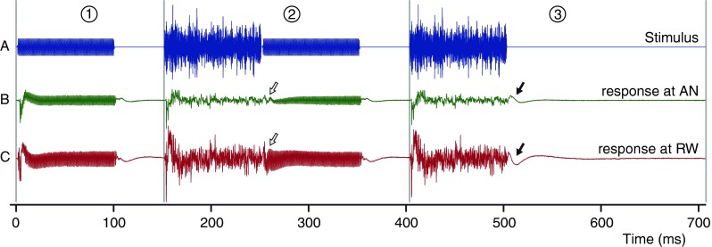 FIG. 1