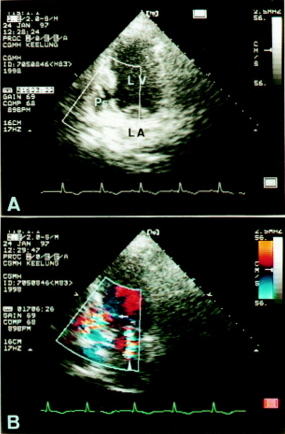 Figure 2  