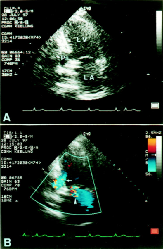 Figure 3  