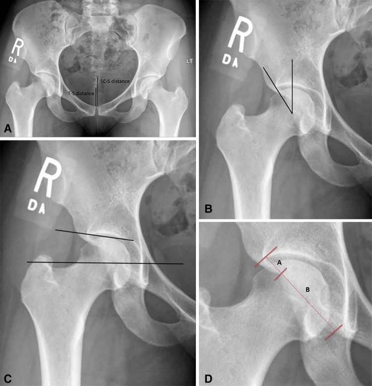 Fig. 1A–D