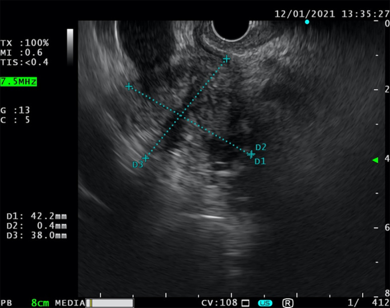 Figure 4