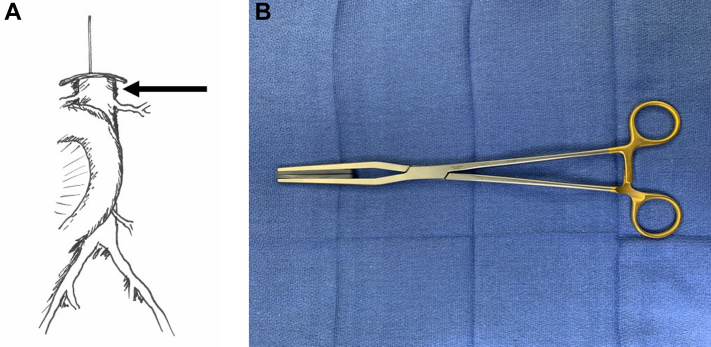 Fig 3