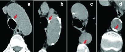 FIG. 5.