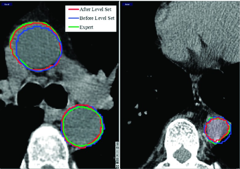 FIG. 4.