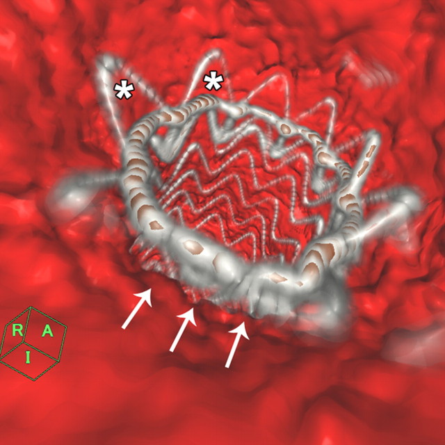 Figure 1b: