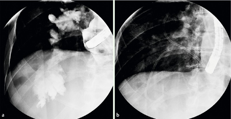 Fig. 3 a