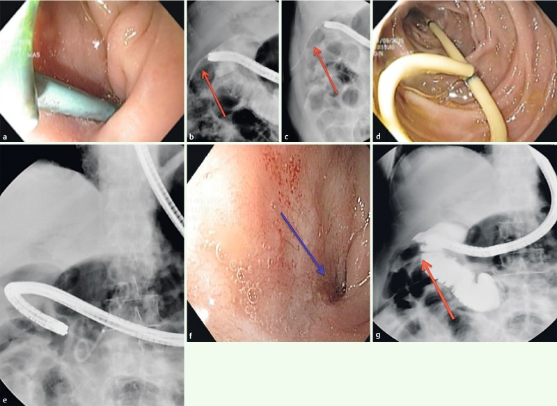 Fig. 4 a 