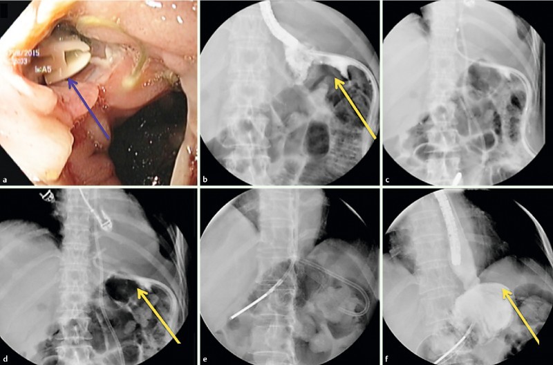 Fig. 1 a 