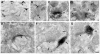 Fig. 11