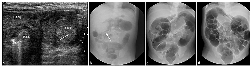 Fig. 12.