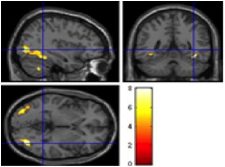 FIGURE 1