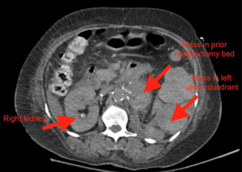 Fig. 1b