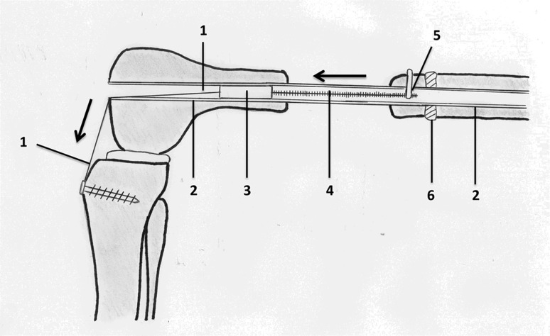 Fig. 1