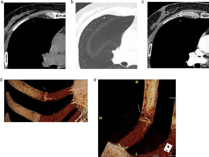 Fig 2 –