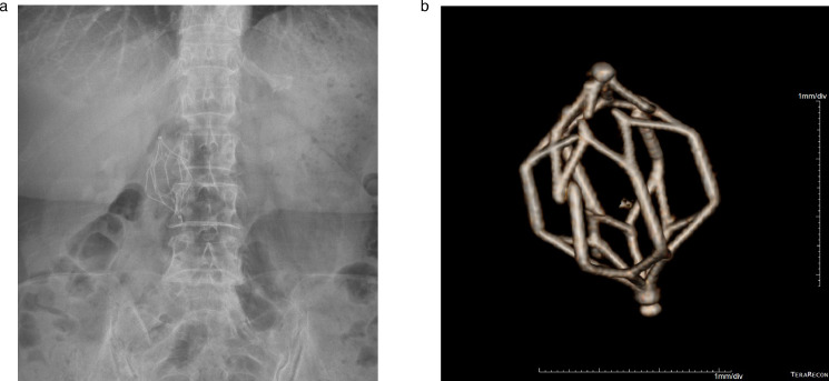 Fig 3 –