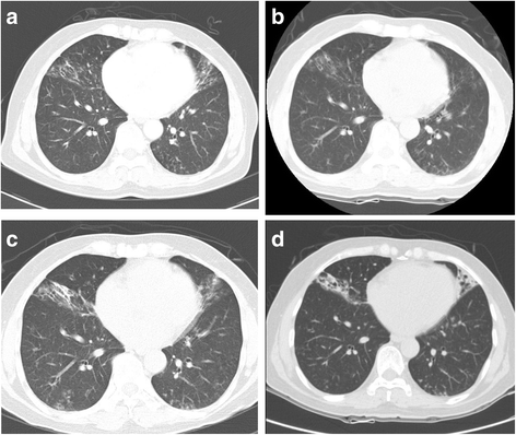Fig. 1