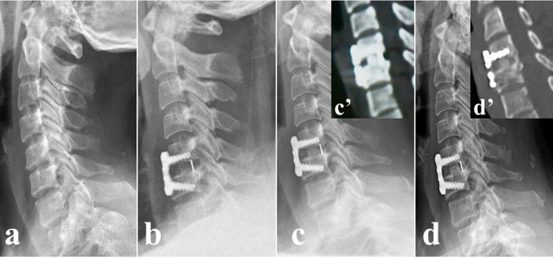 Fig. 2