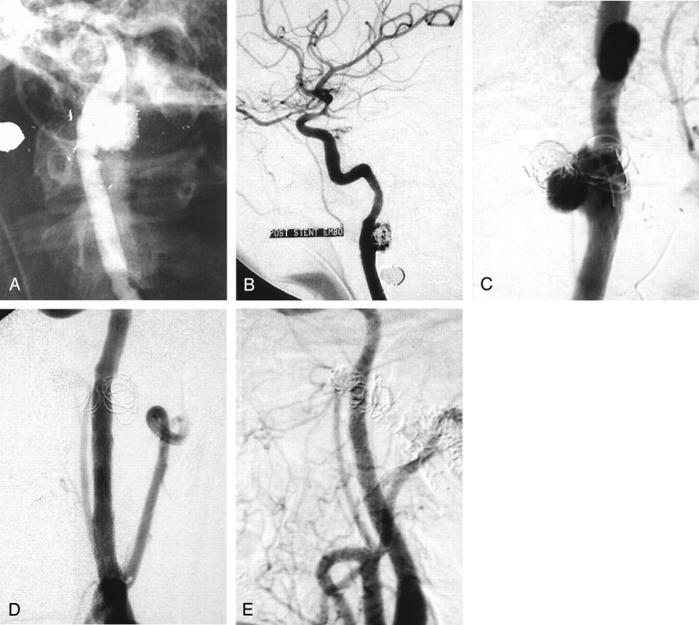 Fig 2.