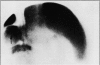 245