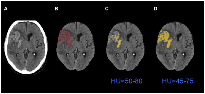 Figure 6