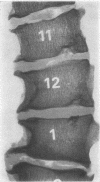 128